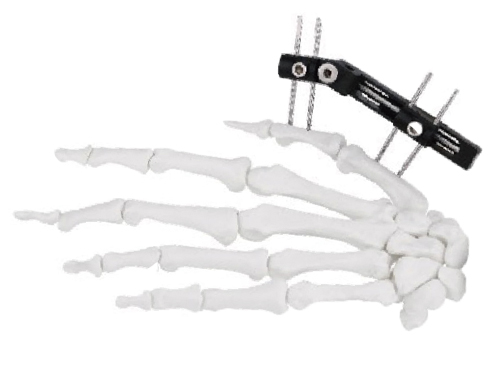 企业建站必须留意的三要素