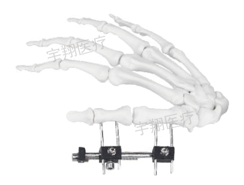 股骨头骨折的治疗医院怎么进行治疗呢？