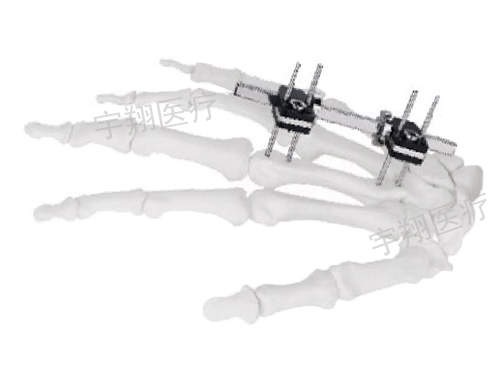 骨科疾病的检查治疗方法有哪些？