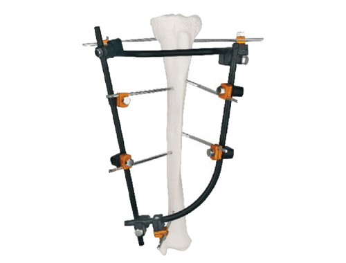 多功能外固定支架的配件有哪些？